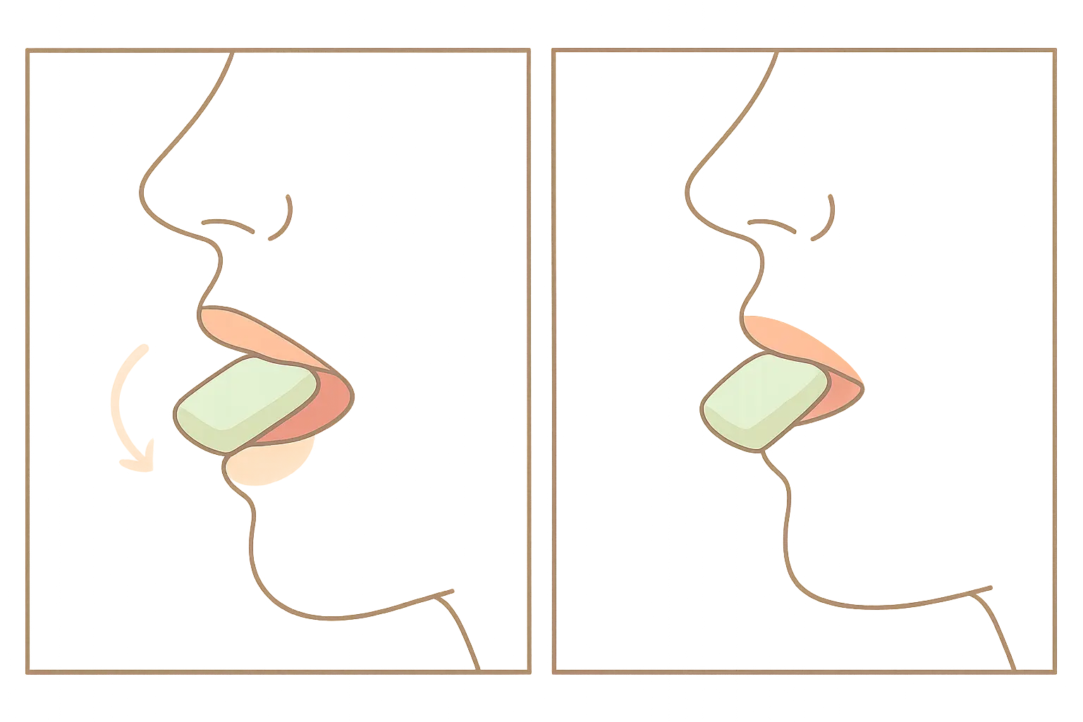Diagram illustrating the chew-and-park technique for using nicotine gum correctly