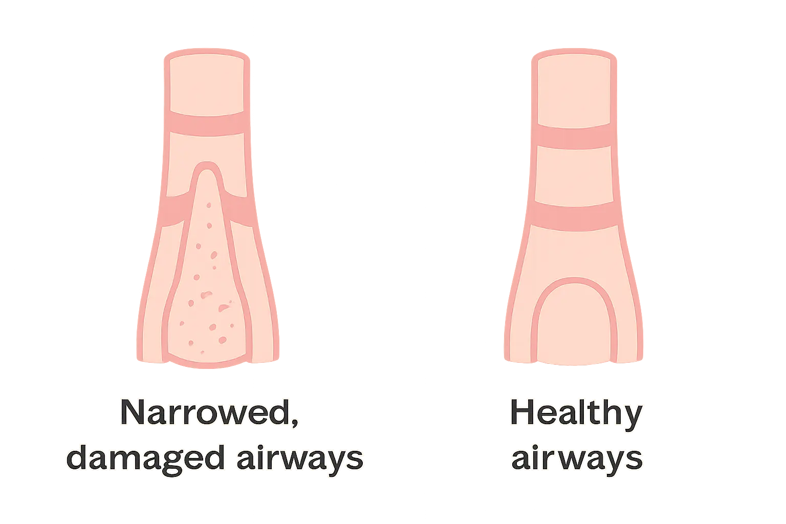 Illustration of a person using an inhaler with a simplified lung diagram