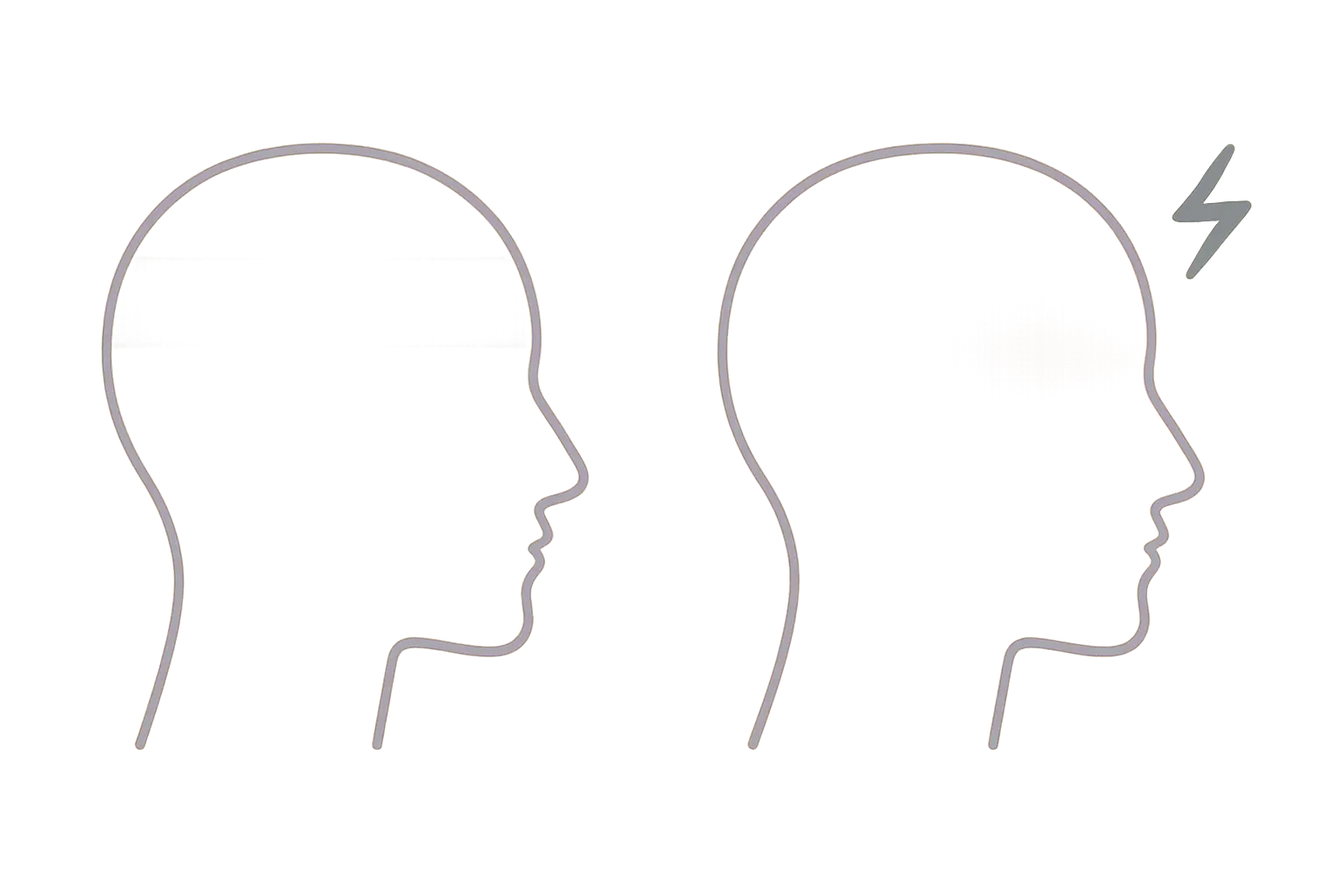 Diagram comparing a band of pain wrapping around the whole head with a one-sided throbbing glow beside a zigzag aura shape